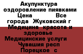 Акупунктура, оздоровление пиявками › Цена ­ 3 000 - Все города, Жуковский г. Медицина, красота и здоровье » Медицинские услуги   . Чувашия респ.,Порецкое. с.